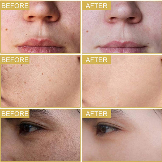 Serum anti-rides de jeunesse nouvelle technologie au japon gab