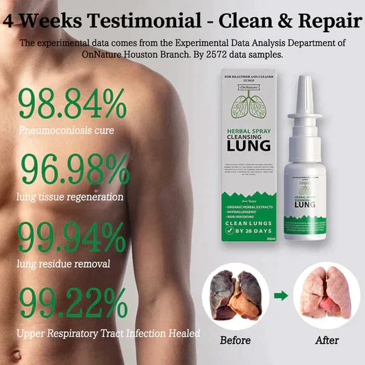 Offre Spéciale: 2 Sprays Herbal Lung pour une Respiration Saine
Poumons Propres, Respiration Légère - Pack 2 Pièces